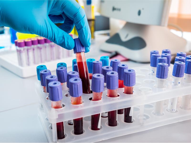 Primavera do Leste começa a coletar amostras para exames de HIV